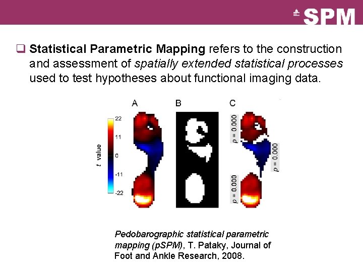 q Statistical Parametric Mapping refers to the construction and assessment of spatially extended statistical