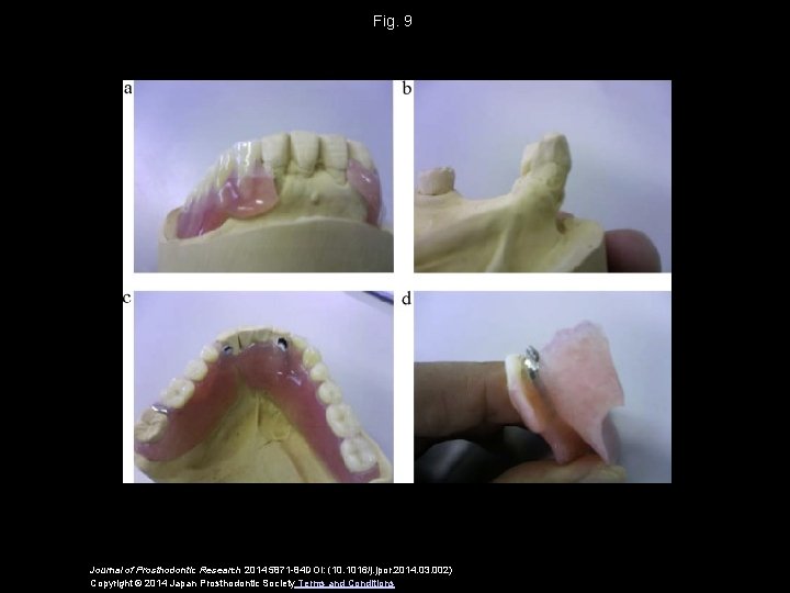 Fig. 9 Journal of Prosthodontic Research 2014 5871 -84 DOI: (10. 1016/j. jpor. 2014.