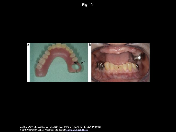 Fig. 10 Journal of Prosthodontic Research 2014 5871 -84 DOI: (10. 1016/j. jpor. 2014.