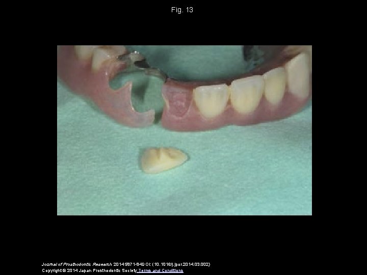 Fig. 13 Journal of Prosthodontic Research 2014 5871 -84 DOI: (10. 1016/j. jpor. 2014.