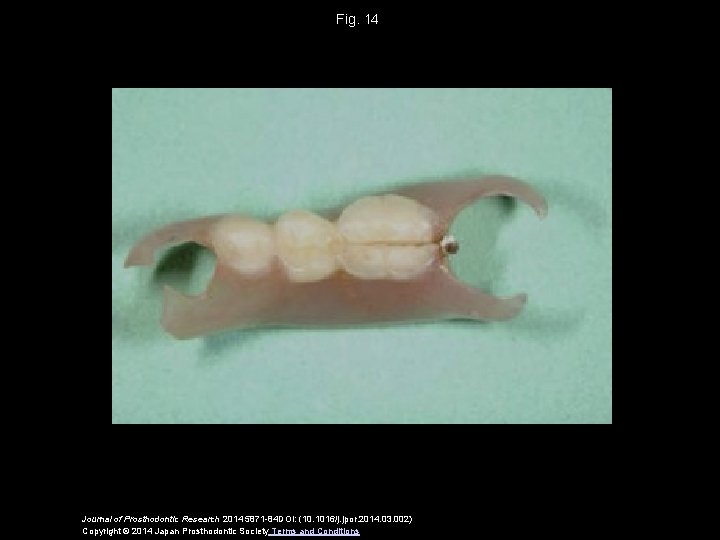 Fig. 14 Journal of Prosthodontic Research 2014 5871 -84 DOI: (10. 1016/j. jpor. 2014.