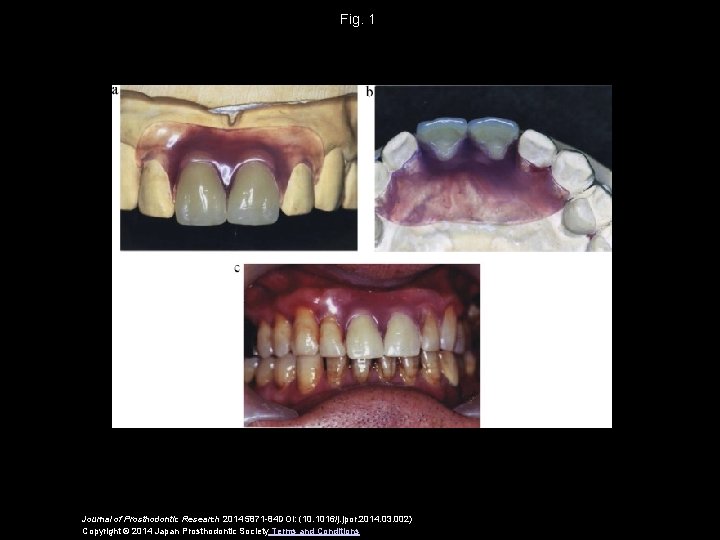 Fig. 1 Journal of Prosthodontic Research 2014 5871 -84 DOI: (10. 1016/j. jpor. 2014.