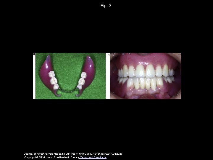 Fig. 3 Journal of Prosthodontic Research 2014 5871 -84 DOI: (10. 1016/j. jpor. 2014.