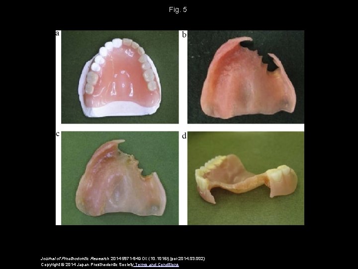 Fig. 5 Journal of Prosthodontic Research 2014 5871 -84 DOI: (10. 1016/j. jpor. 2014.