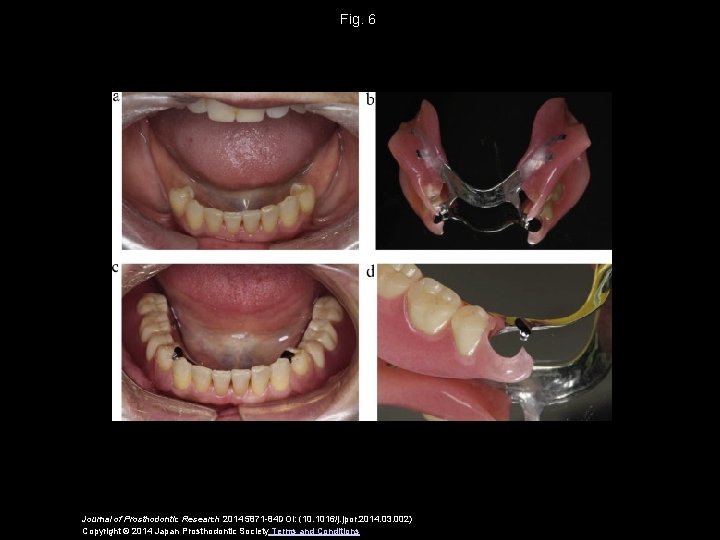 Fig. 6 Journal of Prosthodontic Research 2014 5871 -84 DOI: (10. 1016/j. jpor. 2014.