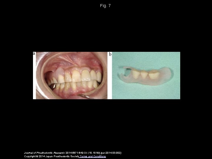 Fig. 7 Journal of Prosthodontic Research 2014 5871 -84 DOI: (10. 1016/j. jpor. 2014.