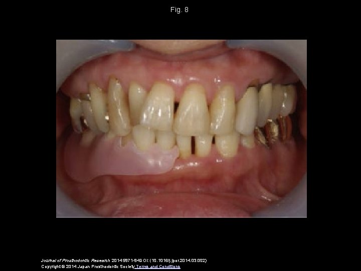 Fig. 8 Journal of Prosthodontic Research 2014 5871 -84 DOI: (10. 1016/j. jpor. 2014.