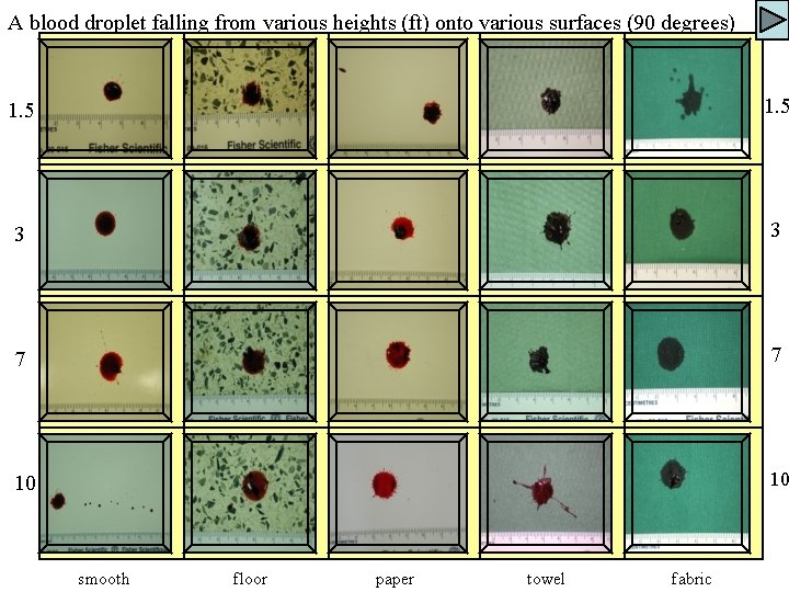 A blood droplet falling from various heights (ft) onto various surfaces (90 degrees) 1.