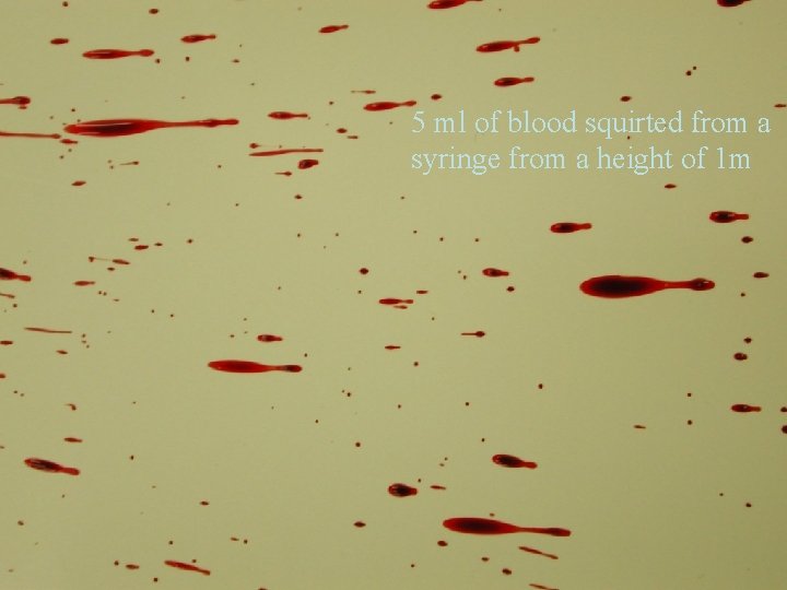 5 ml of blood squirted from a syringe from a height of 1 m