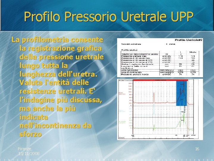 Profilo Pressorio Uretrale UPP La profilometria consente la registrazione grafica della pressione uretrale lungo