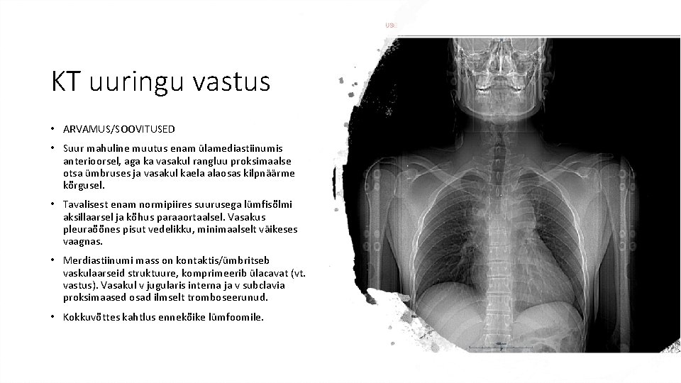 KT uuringu vastus • ARVAMUS/SOOVITUSED • Suur mahuline muutus enam ülamediastiinumis anterioorsel, aga ka