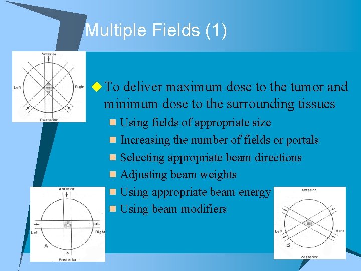 Multiple Fields (1) u To deliver maximum dose to the tumor and minimum dose