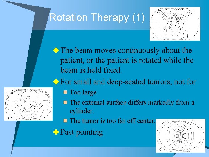 Rotation Therapy (1) u The beam moves continuously about the patient, or the patient