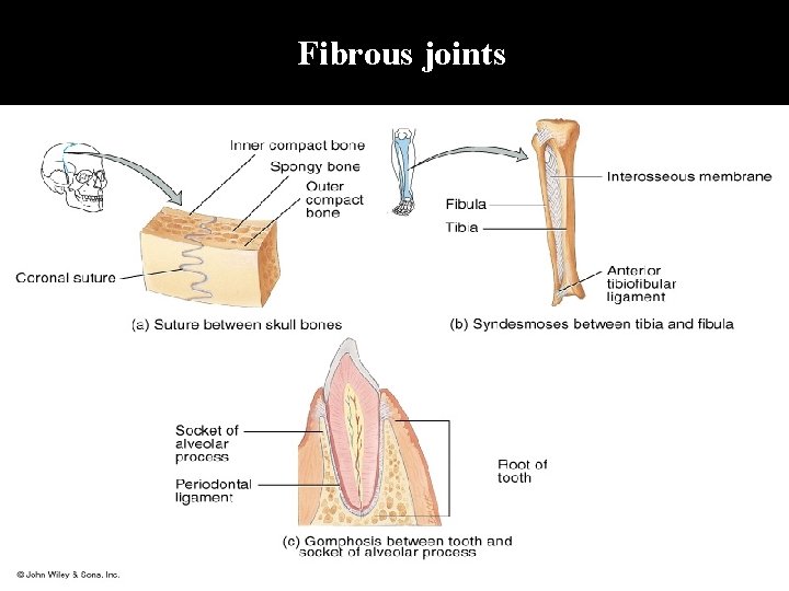 Fibrous joints 