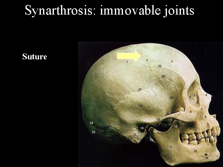 Synarthrosis: immovable joints Suture 