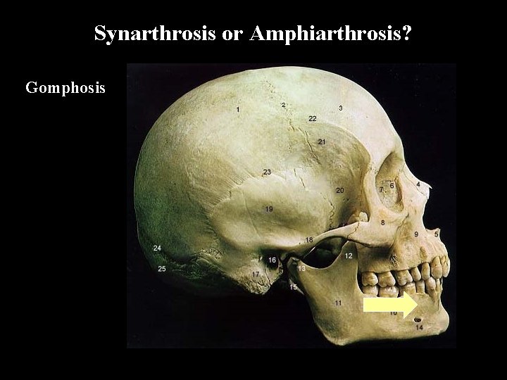 Synarthrosis or Amphiarthrosis? Gomphosis 
