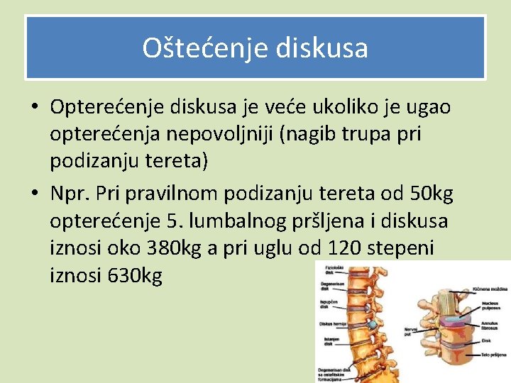 Oštećenje diskusa • Opterećenje diskusa je veće ukoliko je ugao opterećenja nepovoljniji (nagib trupa