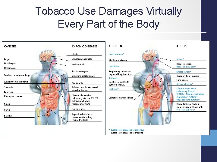 Tobacco Use Damages Virtually Every Part of the Body Smoking Secondhand Smoke 