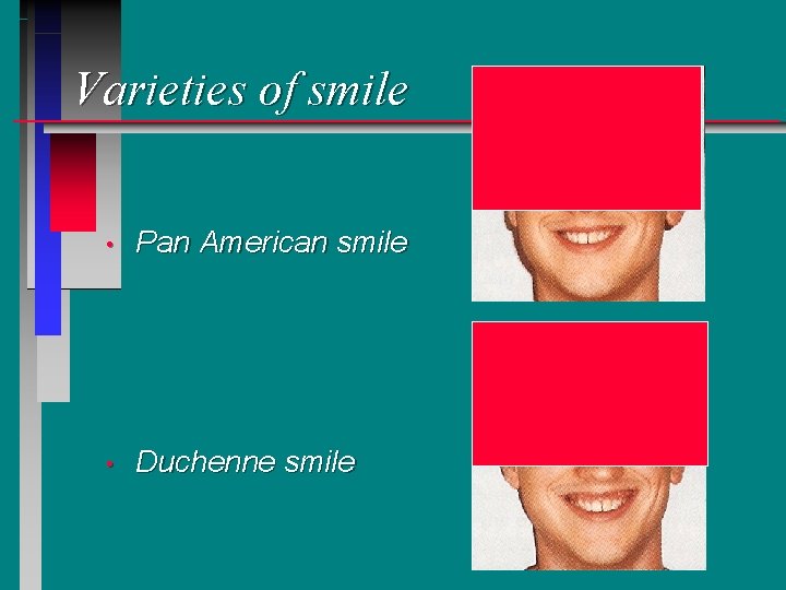 Varieties of smile • Pan American smile • Duchenne smile 