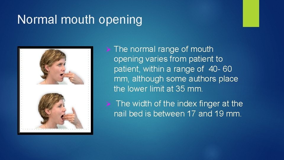 Normal mouth opening Ø The normal range of mouth opening varies from patient to