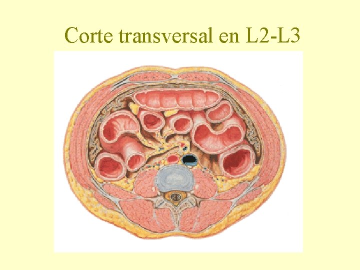 Corte transversal en L 2 -L 3 