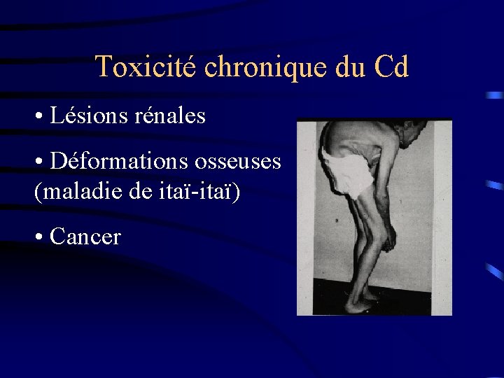 Toxicité chronique du Cd • Lésions rénales • Déformations osseuses (maladie de itaï-itaï) •