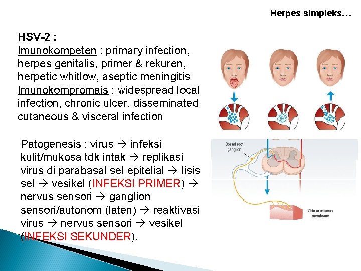 Herpes simpleks… HSV-2 : Imunokompeten : primary infection, herpes genitalis, primer & rekuren, herpetic Herpes simpleks… HSV-2 : Imunokompeten : primary infection, herpes genitalis, primer & rekuren, herpetic