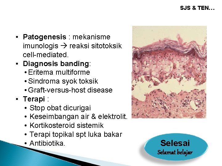 SJS & TEN… • Patogenesis : mekanisme imunologis reaksi sitotoksik cell-mediated. • Diagnosis banding: SJS & TEN… • Patogenesis : mekanisme imunologis reaksi sitotoksik cell-mediated. • Diagnosis banding: