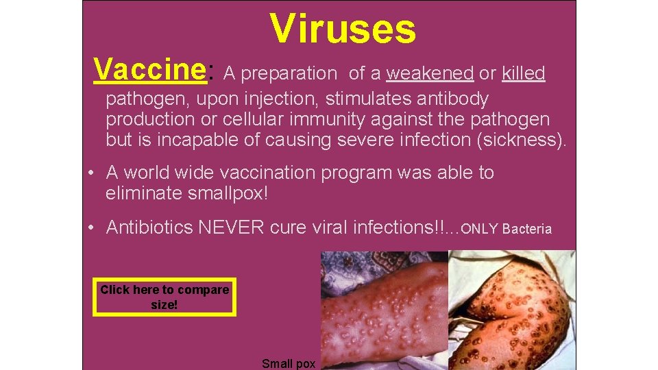 Viruses Vaccine: A preparation of a weakened or killed pathogen, upon injection, stimulates antibody