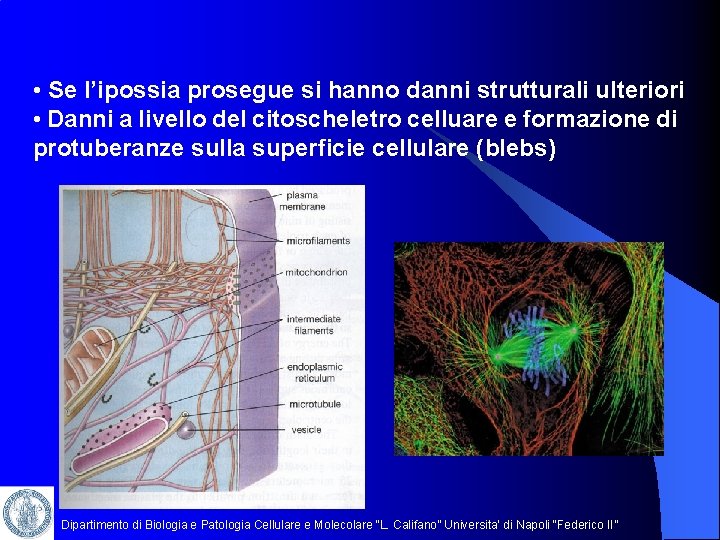  • Se l’ipossia prosegue si hanno danni strutturali ulteriori • Danni a livello