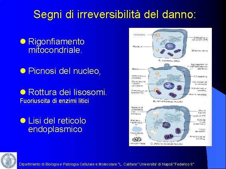 Segni di irreversibilità del danno: l Rigonfiamento mitocondriale. l Picnosi del nucleo, l Rottura