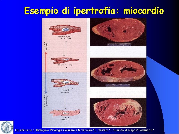 Esempio di ipertrofia: miocardio Dipartimento di Biologia e Patologia Cellulare e Molecolare “L. Califano”