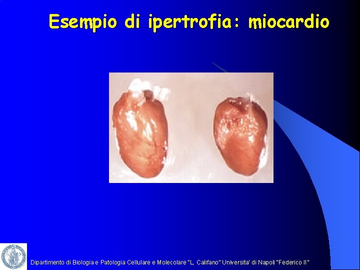 Esempio di ipertrofia: miocardio Dipartimento di Biologia e Patologia Cellulare e Molecolare “L. Califano”