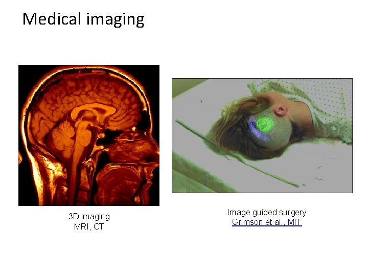 Medical imaging 3 D imaging MRI, CT Image guided surgery Grimson et al. ,