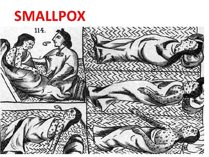 SMALLPOX 