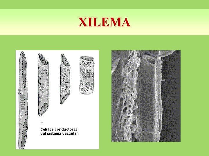 XILEMA 