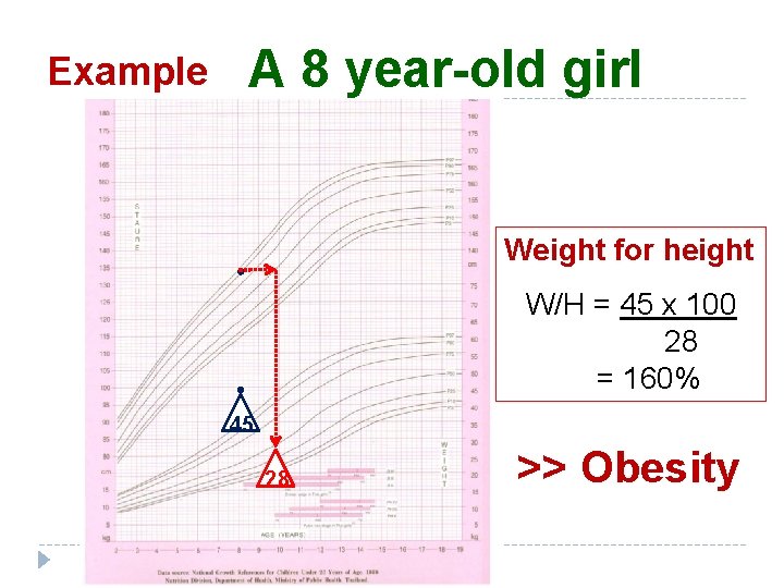 Example A 8 year-old girl Weight for height W/H = 45 x 100 28