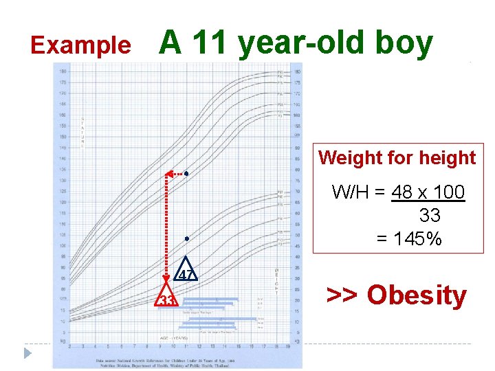 Example A 11 year-old boy Weight for height W/H = 48 x 100 33