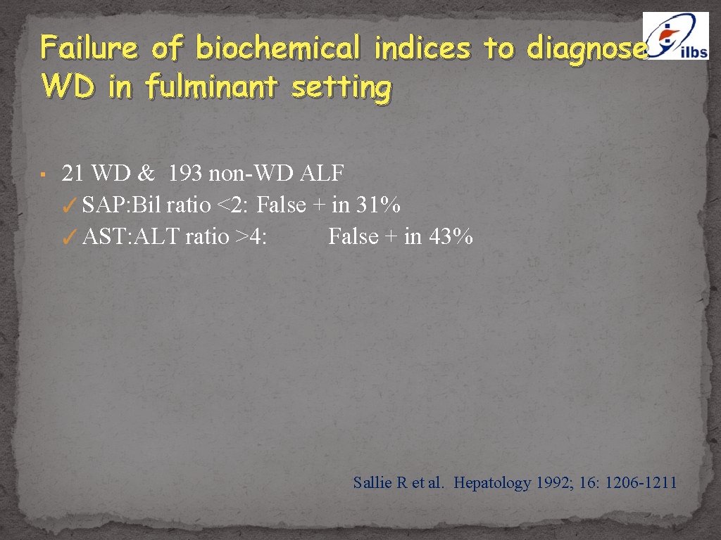 Failure of biochemical indices to diagnose WD in fulminant setting ▪ 21 WD &