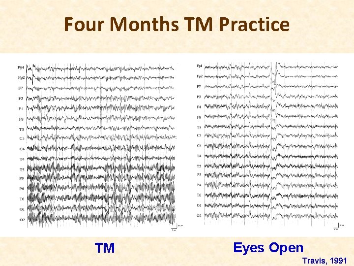 Four Months TM Practice TM Eyes Open Travis, 1991 