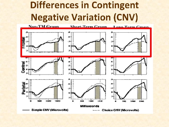 Differences in Contingent Negative Variation (CNV) 