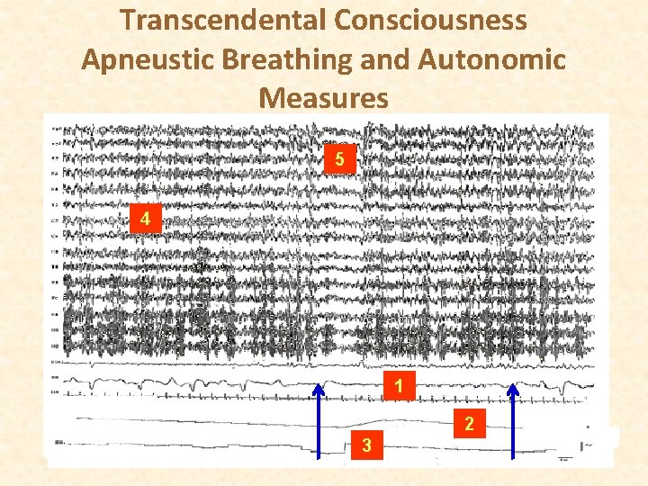 Transcendental Consciousness Apneustic Breathing and Autonomic Measures 5 4 1 2 3 