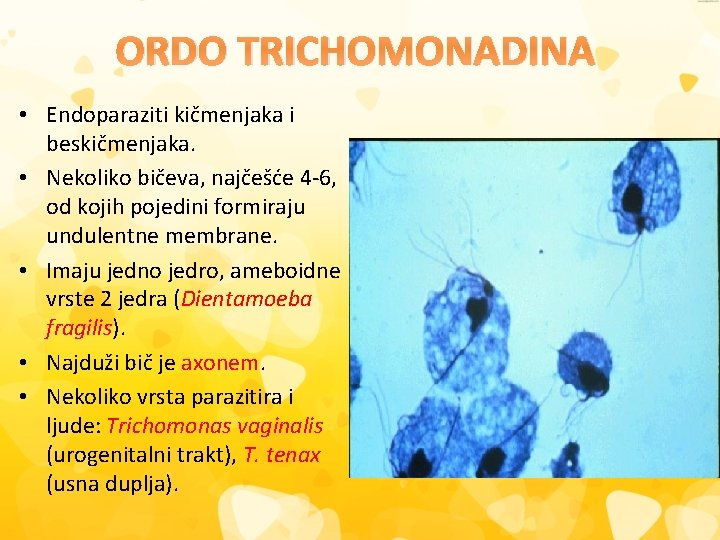 ORDO TRICHOMONADINA • Endoparaziti kičmenjaka i beskičmenjaka. • Nekoliko bičeva, najčešće 4 -6, od