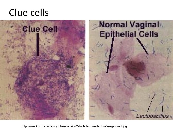 Clue cells http: //www. kcom. edu/faculty/chamberlain/Website/lectures/lecture/image/clue 2. jpg 