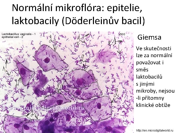 Normální mikroflóra: epitelie, laktobacily (Döderleinův bacil) Giemsa Ve skutečnosti lze za normální považovat i