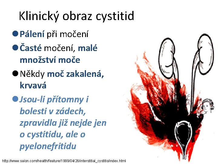 Klinický obraz cystitid l Pálení při močení l Časté močení, malé množství moče l