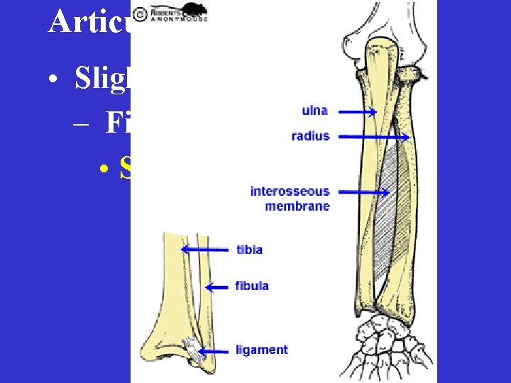 Articulations • Slightly Movable – Fibrous • Syndesmosis 