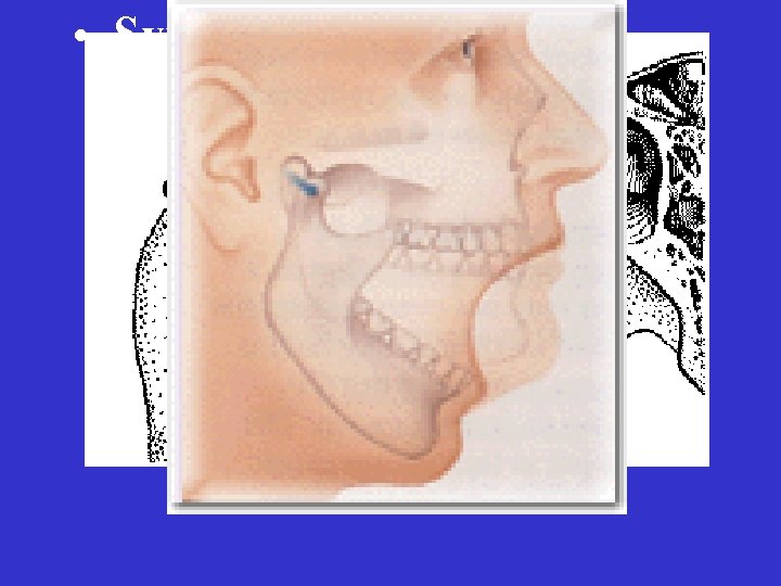  • Synovial Joint Accessory Structures – Menisci 