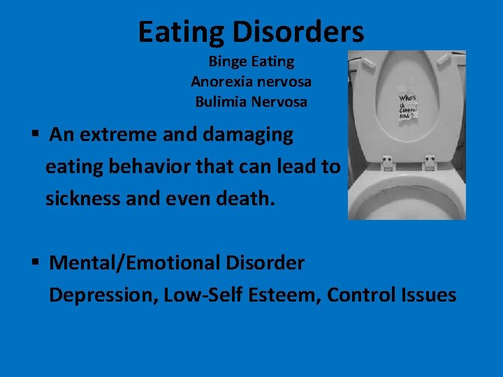 Eating Disorders Binge Eating Anorexia nervosa Bulimia Nervosa § An extreme and damaging eating