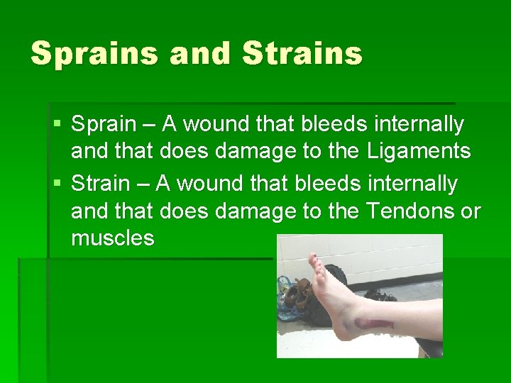 Sprains and Strains § Sprain – A wound that bleeds internally and that does